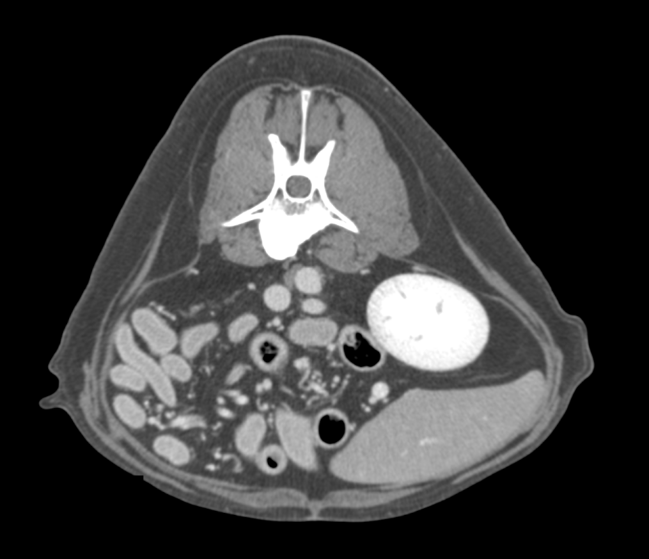 CT — contrast-enhanced abdominal study