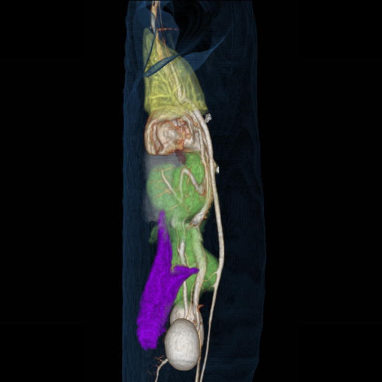 CT 3D reconstruction — diaphragmatic pericardial hernia in a dog