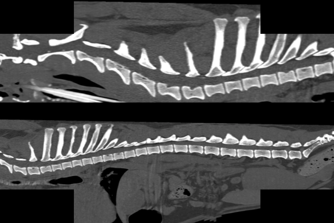 CT — spinal study