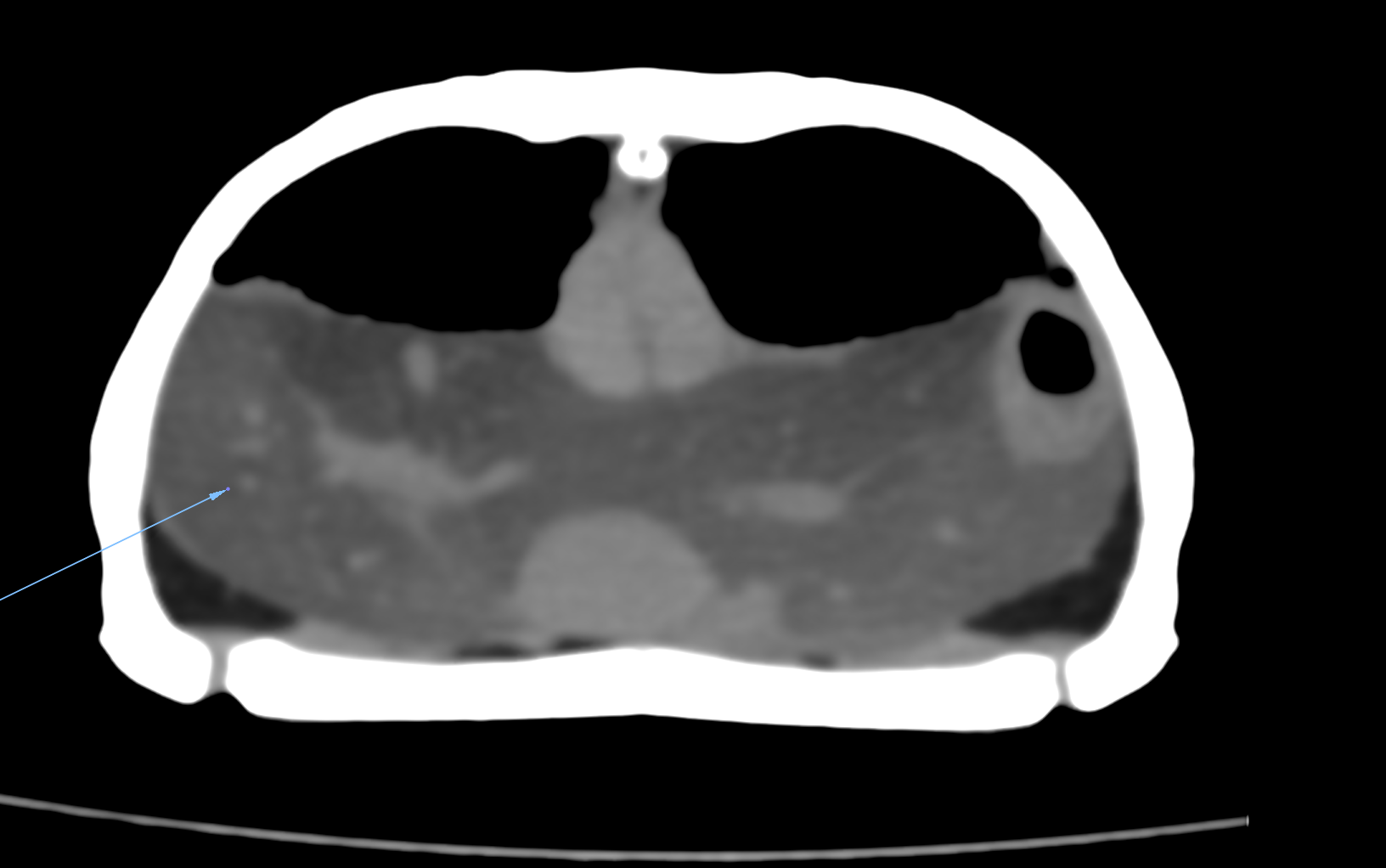 CT — hepatic lipidosis (fatty liver) in a turtle