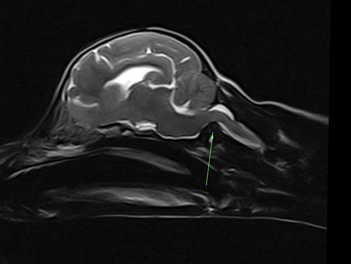 MRI — atlantoaxial subluxation in a dog