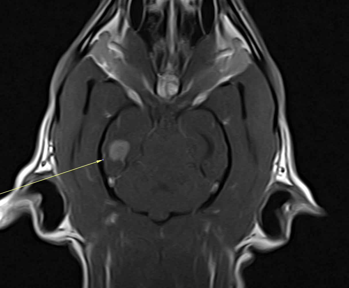 MRI — brain tumor in a dog