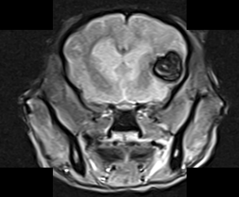 MRI — intracranial hemorrhage